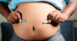 Obésité – Chirurgie Bariatrique –  À qui convient-elle ?