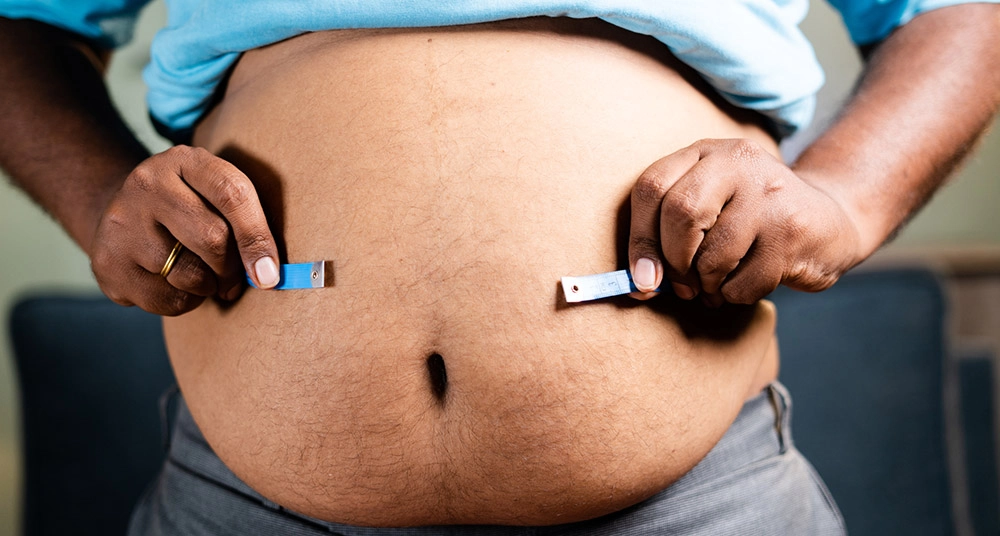 Obésité – Chirurgie Bariatrique –  À qui convient-elle ?
