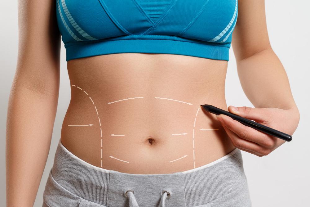 L’abdominoplastie en Turquie / Antalya – un package sans soucis