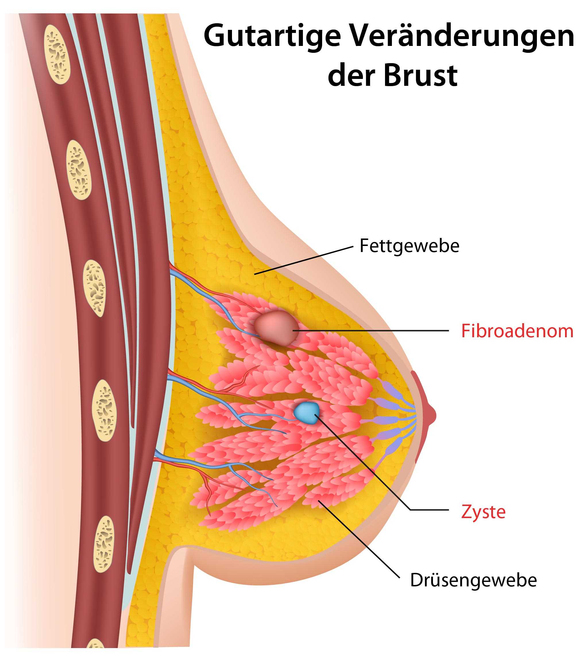 Chirurgie mammaire en Turquie