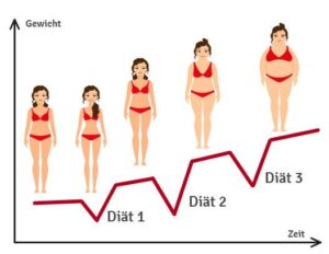 Chirurgie de l’estomac en Turquie – Évitez l’effet yo-yo