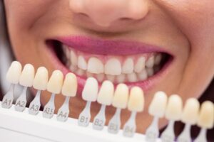 Couronnes en zircone implantées en Turquie – l’avenir de l’esthétique dentaire