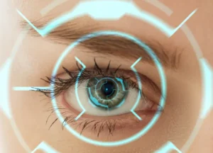 L’implantation artificielle du cristallin