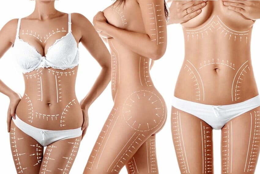 Mommy Makeover retour à la silhouette de rêve