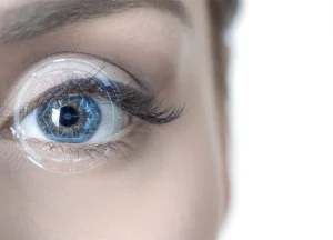 ReLEx Smile Turquie Coût – méthode douce de chirurgie oculaire au laser