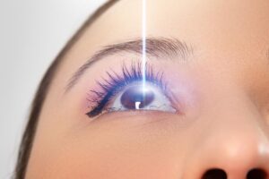 ReLEx Smile – méthode laser oculaire douce et innovante
