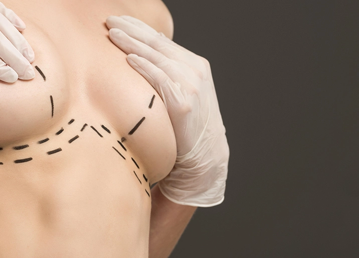 Chirurgie esthétique