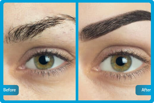 Before After