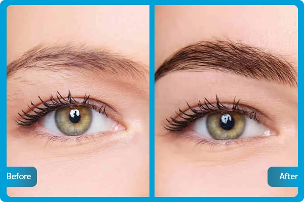 Before After