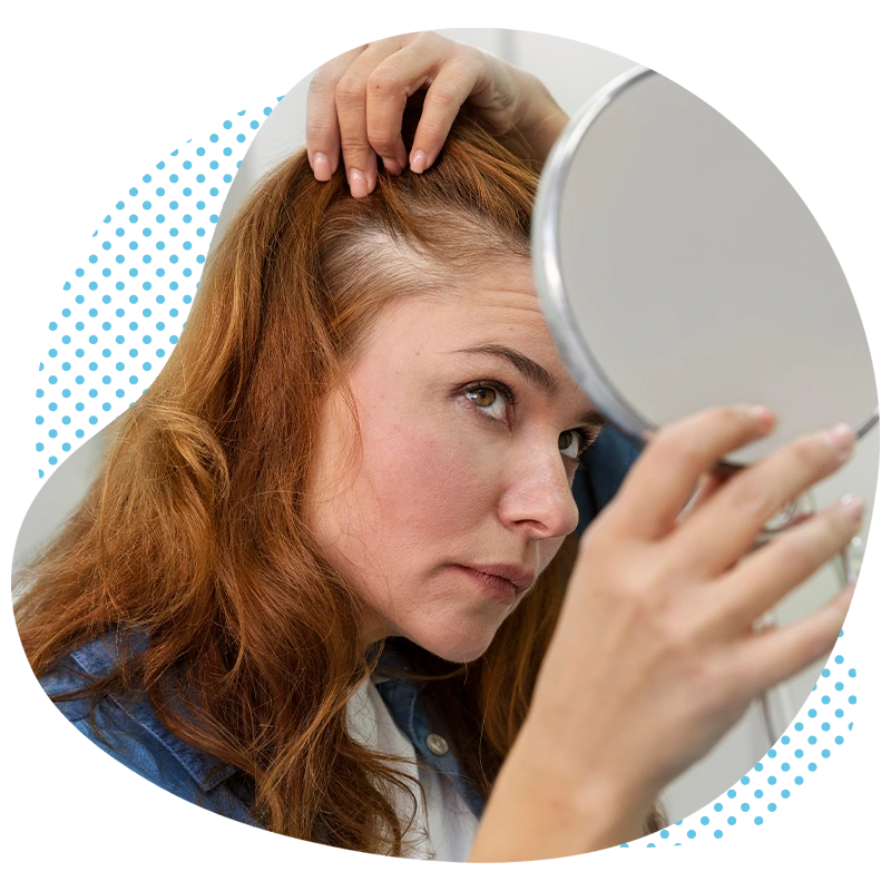 Une greffe de cheveux est-elle possible chez les femmes ?