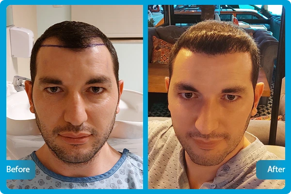 Before After