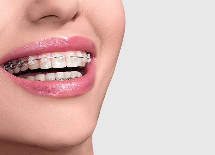 L’orthodontie