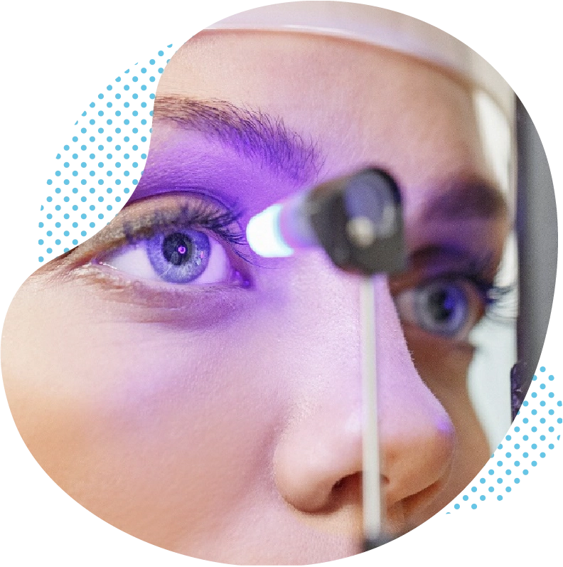 Le LASIK